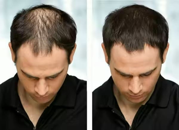 H08ae0125f8f94aafb85ace7eaf547b60A.jpg_720x720q50.jpg